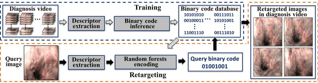 Figure 1 for Robust Image Descriptors for Real-Time Inter-Examination Retargeting in Gastrointestinal Endoscopy