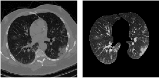Figure 1 for CT-CAPS: Feature Extraction-based Automated Framework for COVID-19 Disease Identification from Chest CT Scans using Capsule Networks