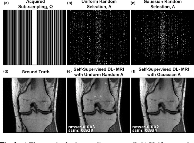Figure 2 for Self-Supervised Physics-Based Deep Learning MRI Reconstruction Without Fully-Sampled Data