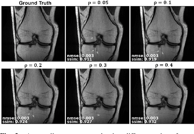 Figure 3 for Self-Supervised Physics-Based Deep Learning MRI Reconstruction Without Fully-Sampled Data