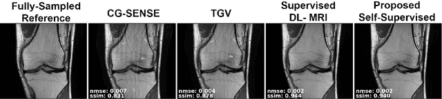 Figure 4 for Self-Supervised Physics-Based Deep Learning MRI Reconstruction Without Fully-Sampled Data