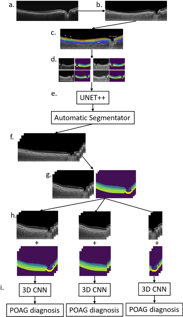 Figure 1 for Are Macula or Optic Nerve Head Structures better at Diagnosing Glaucoma? An Answer using AI and Wide-Field Optical Coherence Tomography