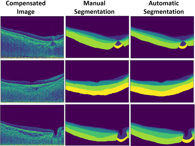 Figure 4 for Are Macula or Optic Nerve Head Structures better at Diagnosing Glaucoma? An Answer using AI and Wide-Field Optical Coherence Tomography