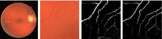 Figure 4 for U-Net with Graph Based Smoothing Regularizer for Small Vessel Segmentation on Fundus Image