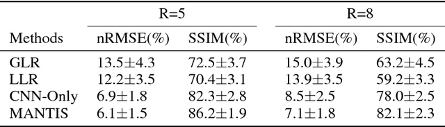 Figure 2 for MANTIS: Model-Augmented Neural neTwork with Incoherent k-space Sampling for efficient MR T2 mapping