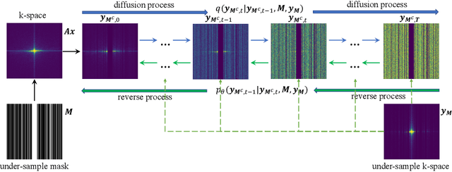 Figure 1 for Measurement-conditioned Denoising Diffusion Probabilistic Model for Under-sampled Medical Image Reconstruction