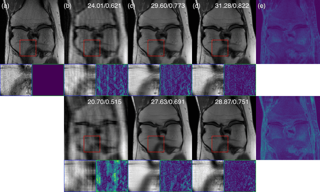 Figure 3 for Measurement-conditioned Denoising Diffusion Probabilistic Model for Under-sampled Medical Image Reconstruction