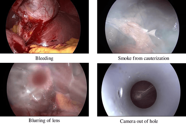 Figure 2 for Unsupervised anomaly detection for a Smart Autonomous Robotic Assistant Surgeon (SARAS)using a deep residual autoencoder