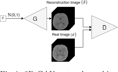 Figure 1 for Unsupervised 3D Brain Anomaly Detection