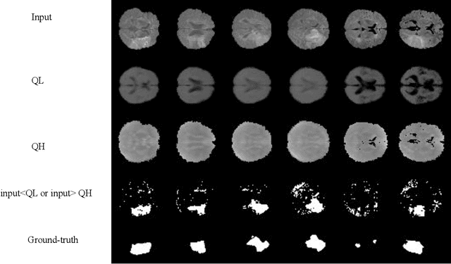 Figure 3 for Addressing Variance Shrinkage in Variational Autoencoders using Quantile Regression