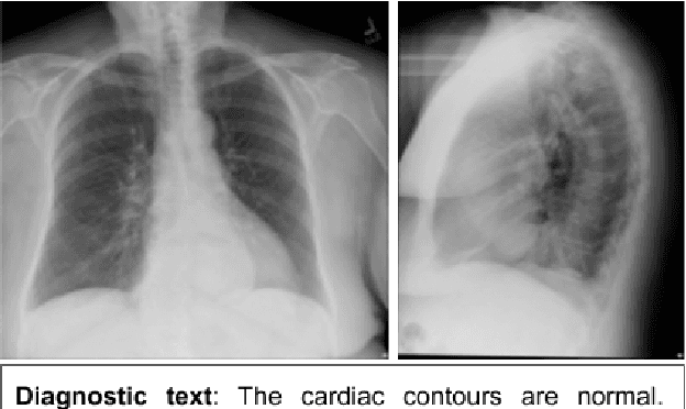 Figure 1 for RTEX: A novel methodology for Ranking, Tagging, and Explanatory diagnostic captioning of radiography exams