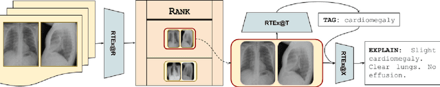 Figure 3 for RTEX: A novel methodology for Ranking, Tagging, and Explanatory diagnostic captioning of radiography exams