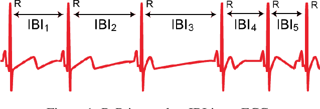 Figure 1 for Inter-Beat Interval Estimation with Tiramisu Model: A Novel Approach with Reduced Error