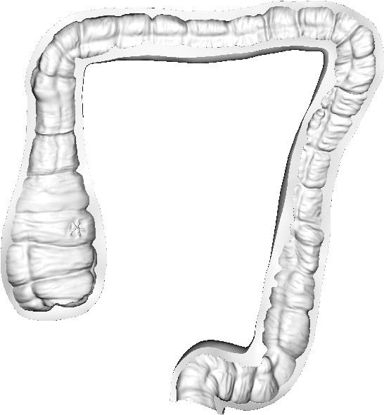 Figure 4 for Colonoscopy 3D Video Dataset with Paired Depth from 2D-3D Registration