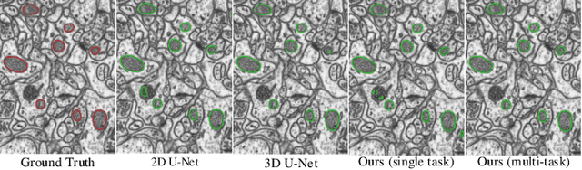 Figure 4 for EM-NET: Centerline-Aware Mitochondria Segmentation in EM Images via Hierarchical View-Ensemble Convolutional Network