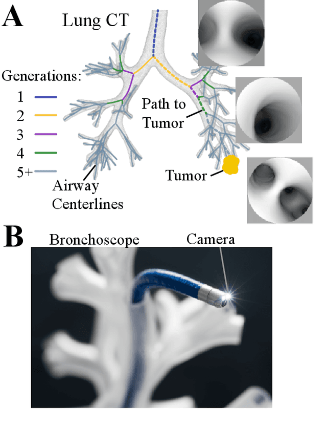 Figure 1 for Autonomous Driving in the Lung using Deep Learning for Localization