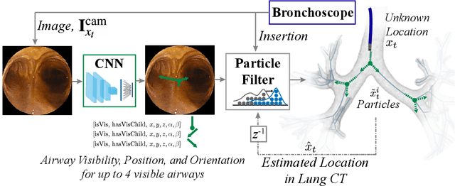 Figure 3 for Autonomous Driving in the Lung using Deep Learning for Localization