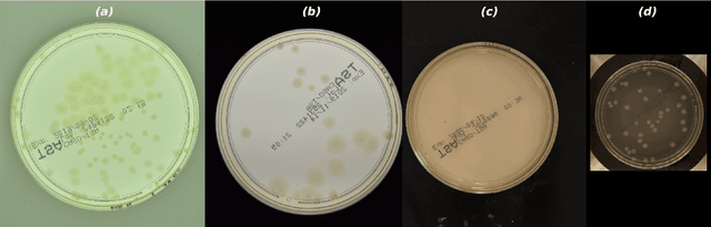 Figure 2 for AGAR a microbial colony dataset for deep learning detection