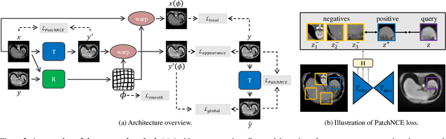 Figure 3 for Unsupervised Multi-Modal Medical Image Registration via Discriminator-Free Image-to-Image Translation