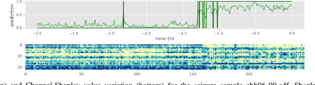 Figure 4 for Patient-independent Epileptic Seizure Prediction using Deep Learning Models