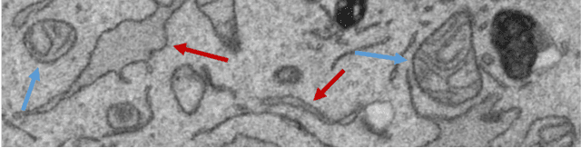 Figure 1 for Convolutional Neural Network Pruning to Accelerate Membrane Segmentation in Electron Microscopy