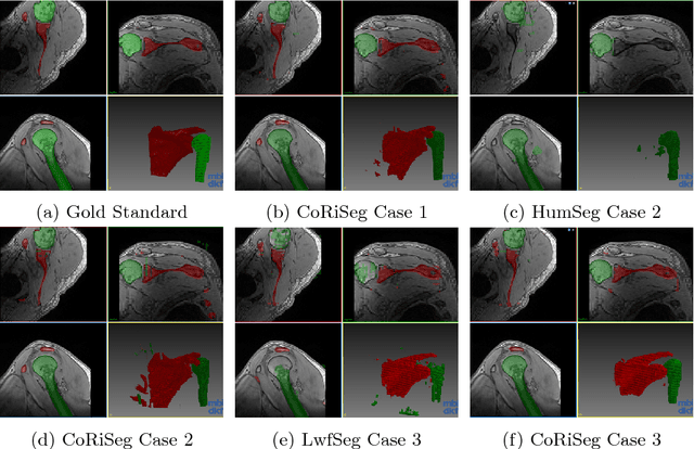 Figure 4 for Learn the new, keep the old: Extending pretrained models with new anatomy and images