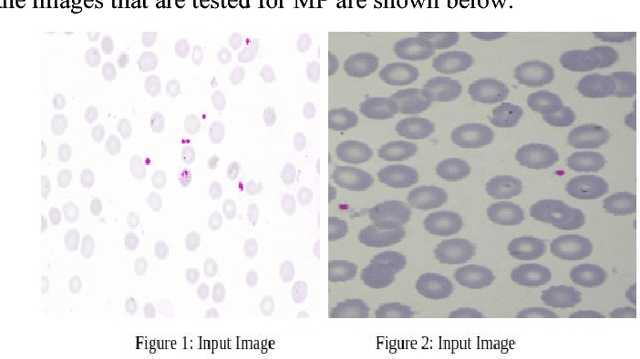 Figure 2 for Malaria Detection Using Image Processing and Machine Learning