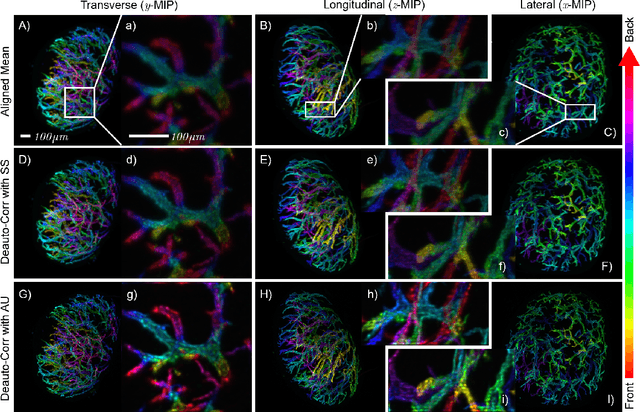 Figure 3 for Beyond multi-view deconvolution for inherently-aligned fluorescence tomography