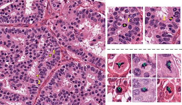 Figure 1 for Cell Detection in Microscopy Images with Deep Convolutional Neural Network and Compressed Sensing