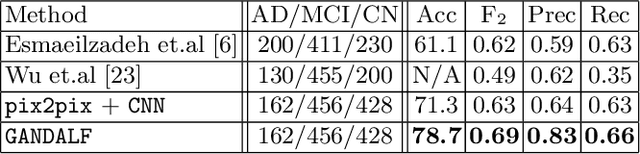 Figure 4 for GANDALF: Generative Adversarial Networks with Discriminator-Adaptive Loss Fine-tuning for Alzheimer's Disease Diagnosis from MRI