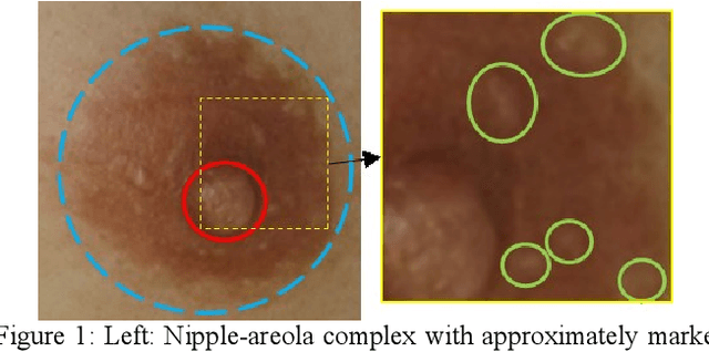 Figure 1 for The Nipple-Areola Complex for Criminal Identification