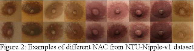 Figure 3 for The Nipple-Areola Complex for Criminal Identification