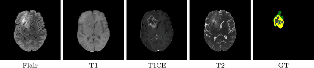 Figure 1 for Reciprocal Adversarial Learning for Brain Tumor Segmentation: A Solution to BraTS Challenge 2021 Segmentation Task