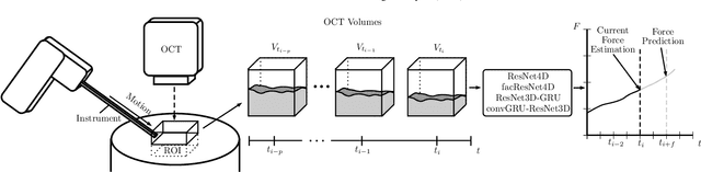 Figure 1 for Deep learning with 4D spatio-temporal data representations for OCT-based force estimation