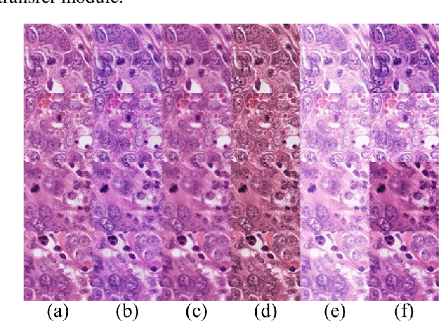 Figure 3 for Domain-Robust Mitotic Figure Detection with Style Transfer