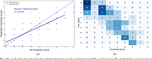 Figure 2 for COVID-19 in CXR: from Detection and Severity Scoring to Patient Disease Monitoring