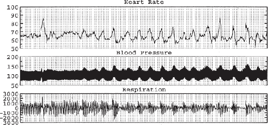 Figure 4 for Mapping Temporal Variables into the NeuCube for Improved Pattern Recognition, Predictive Modelling and Understanding of Stream Data