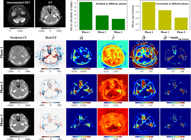 Figure 3 for Uncertainty-Guided Progressive GANs for Medical Image Translation