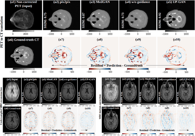 Figure 4 for Uncertainty-Guided Progressive GANs for Medical Image Translation