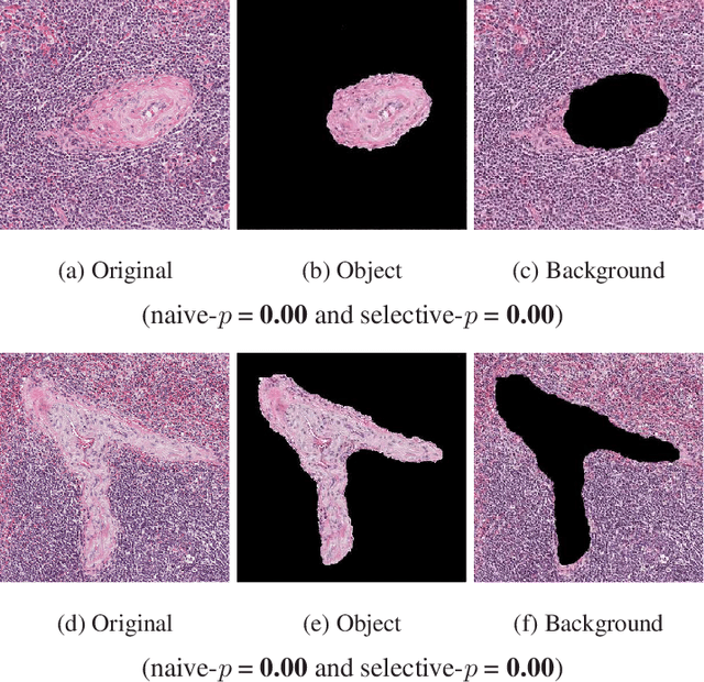 Figure 4 for Computing Valid p-values for Image Segmentation by Selective Inference