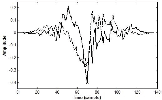 Figure 2 for On the Mutual Information between Source and Filter Contributions for Voice Pathology Detection