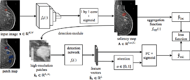 Figure 1 for Globally-Aware Multiple Instance Classifier for Breast Cancer Screening