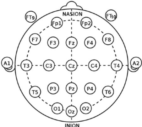 Figure 1 for Spike-and-wave epileptiform discharge pattern detection based on Kendall's Tau-b coefficient