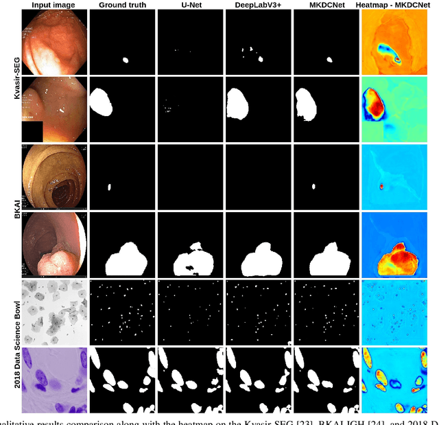Figure 2 for Automatic Polyp Segmentation with Multiple Kernel Dilated Convolution Network