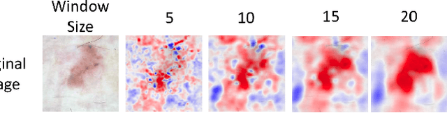 Figure 3 for What evidence does deep learning model use to classify Skin Lesions?