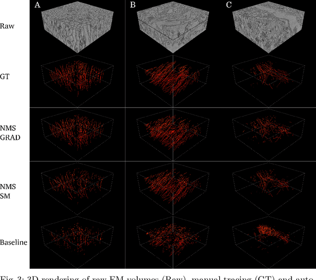 Figure 4 for Microtubule Tracking in Electron Microscopy Volumes