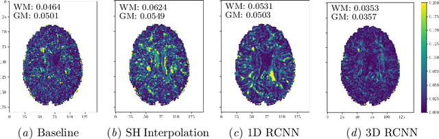 Figure 4 for Angular Super-Resolution in Diffusion MRI with a 3D Recurrent Convolutional Autoencoder