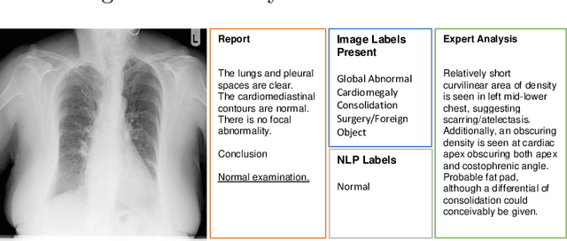 Figure 2 for Caveats in Generating Medical Imaging Labels from Radiology Reports