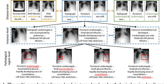 Figure 1 for Multi-Granularity Cross-modal Alignment for Generalized Medical Visual Representation Learning