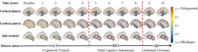 Figure 1 for Deep Recurrent Disease Progression Model for Conversion-Time Prediction of Alzheimer's Disease